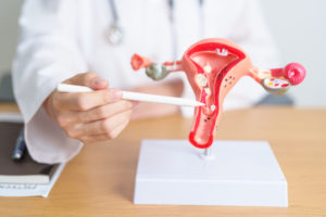 endometriose tem cura